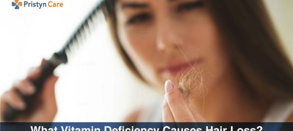 What Vitamin Deficiency Causes Hair Loss?