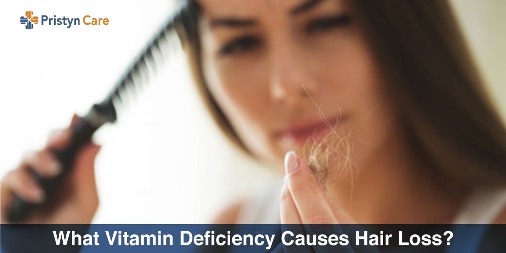What Vitamin Deficiency Causes Hair Loss? - Pristyn Care