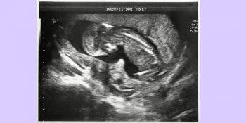What happens in the 9th month of pregnancy - Pristyn Care