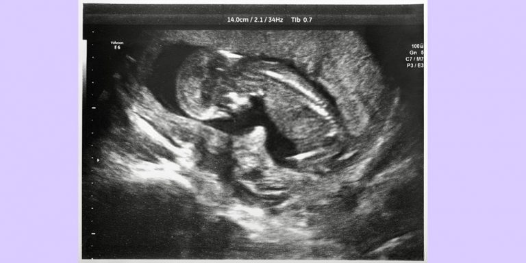 What-happens-in-the-9th-month-of-pregnan