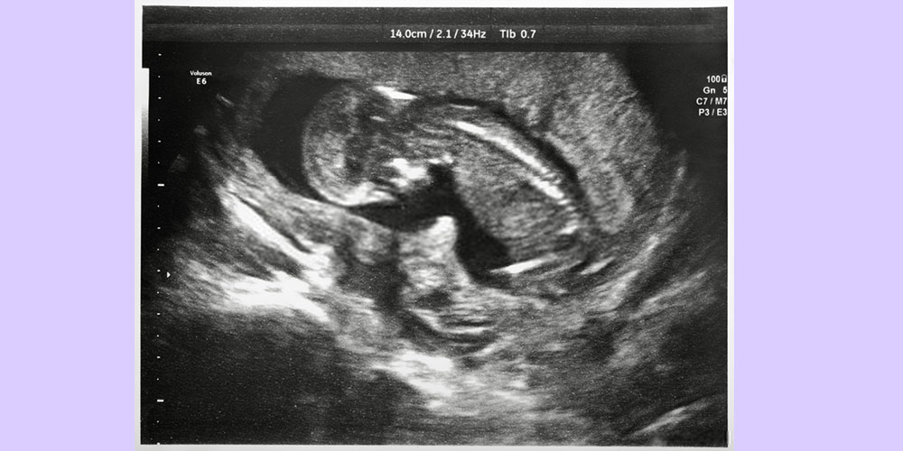 9 month pregnancy ultrasound of the baby
