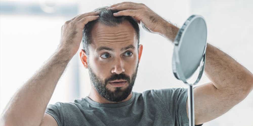 Man looking at hair line in front of a mirror