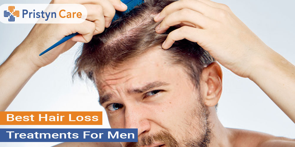 10 Best Hair Loss Treatment Options For Men