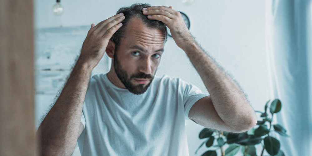 hair loss