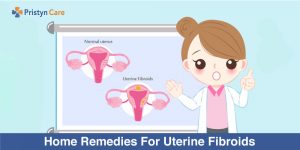 home remedies for uterine fibroids