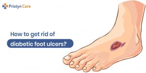 how to get rid of diabetic foot ulcers