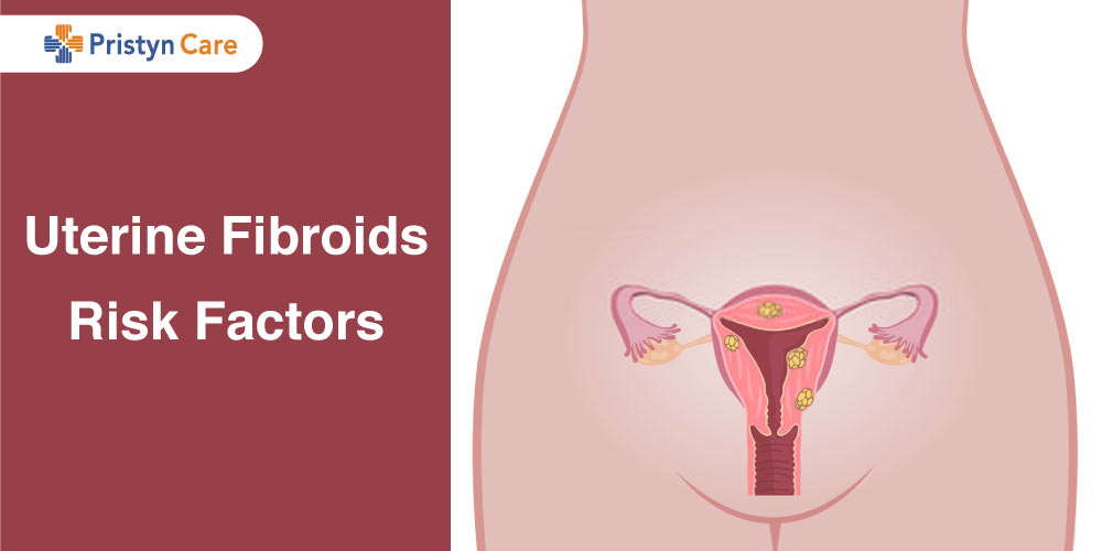 uterine fibroids risk factors