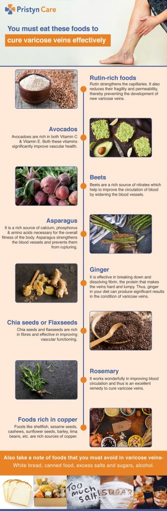 varicose veins foods infographic