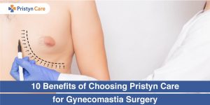 10-Benefits-of-Choosing-Pristyn-Care-for-Gynecomastia-Surgery