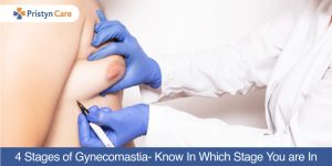 4-Stages-of-Gynecomastia-Know-In-Which-Stage-You-are-In