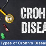 5 types of crohn's disease