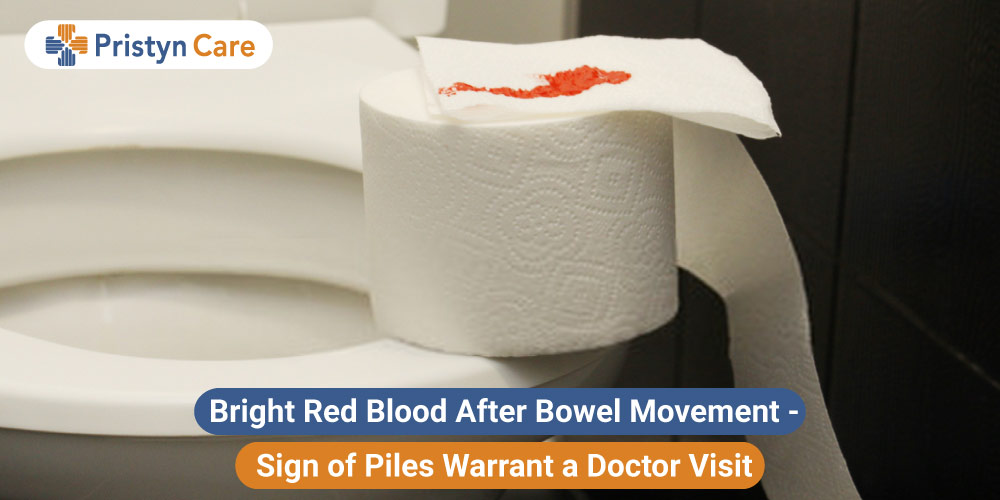 Bright red blood after bowel movement