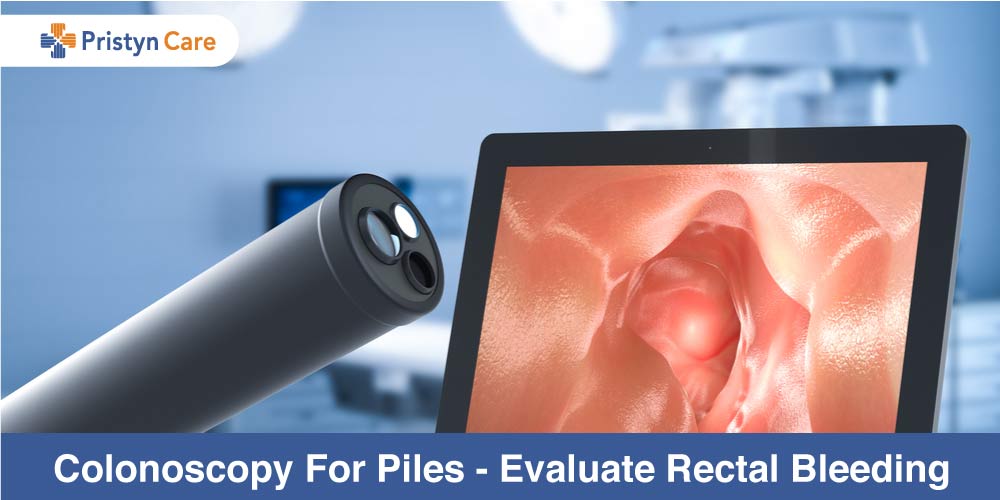 Colonoscopy For Piles