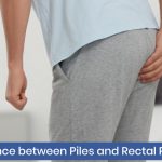 Difference between Piles and rectal prolapse