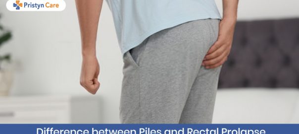 Difference Between Piles And Rectal Prolapse