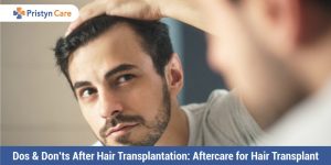Dos-and-Don’ts-After-Hair-Transplantation-Aftercare-for-Hair-Transplant