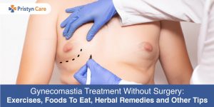 Gynecomastia-Treatment-Without-Surgery-Exercises,-Foods-To-Eat,-Herbal-Remedies-and-Other-Tips