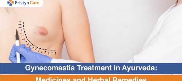 Gynecomastia Treatment in Ayurveda: Medicines and Herbal Remedies