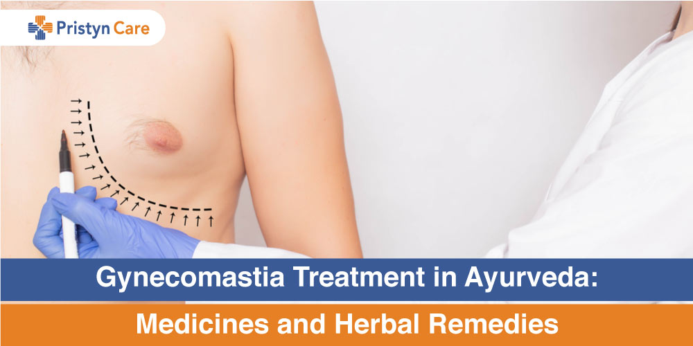 Gynecomastia Treatment In Ayurveda - Medicine, Remedies & Side Effects