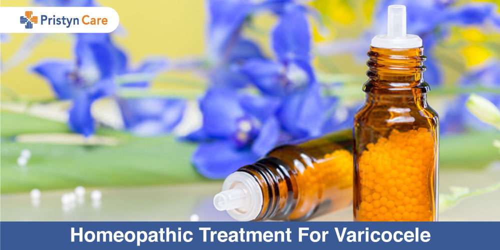 Homeopathic Treatment For Varicocele - Pristyn Care