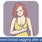 How to prevent breast sagging after pregnancy