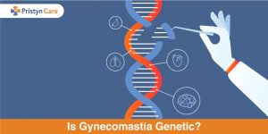 Is-Gynecomastia-Genetic