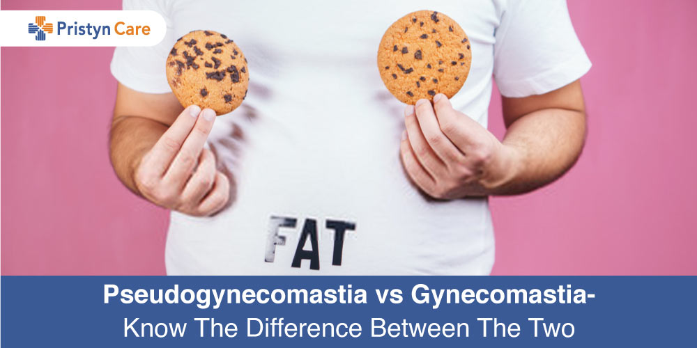 Pseudogynecomastia-vs-Gynecomastia-Know-The-Difference-Between-The-Two