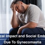 Psychological-Impact-and-Social-Embarrassment-Due-To-Gynecomastia