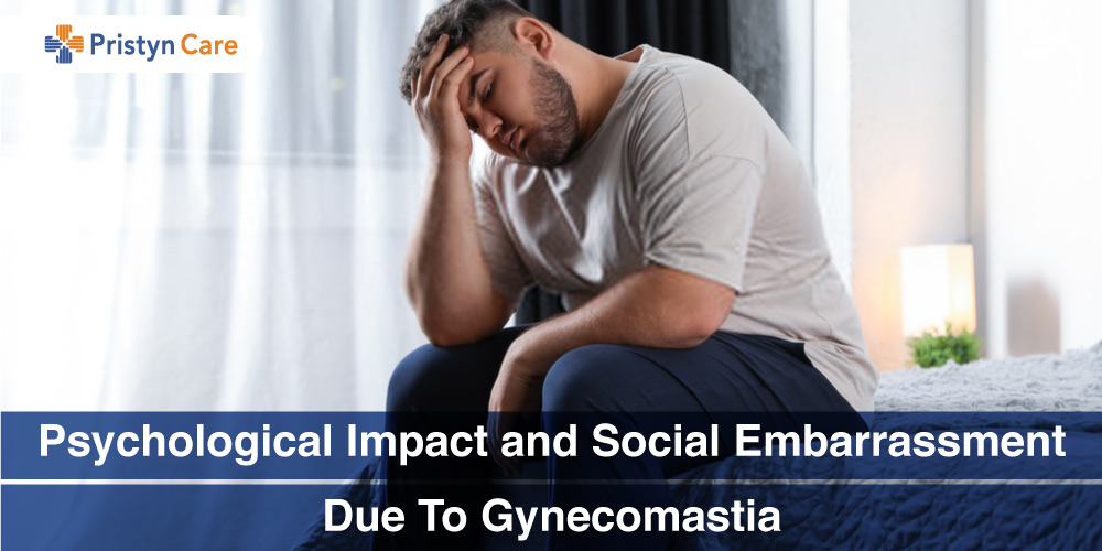 Psychological-Impact-and-Social-Embarrassment-Due-To-Gynecomastia