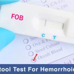 Stool Test for hemorrhoids