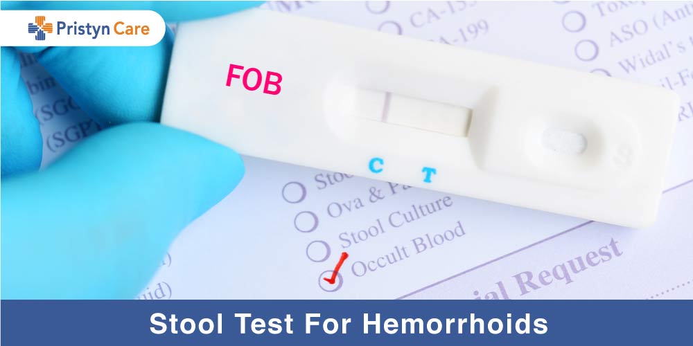 Stool Test for hemorrhoids