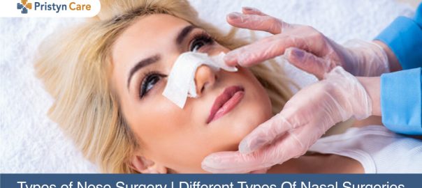 Types of Nose Surgery | Different Types Of Nasal Surgeries