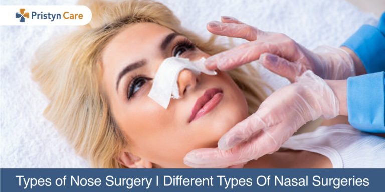 Types-of-Nose-Surgery-Different-Types-Of-Nasal-Surgeries