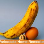 Varicocele-Home-Remedies