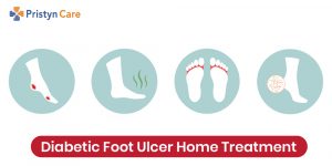 diabetic foot ulcer home treatment