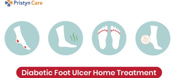 Diabetic Foot Ulcer Home Treatment