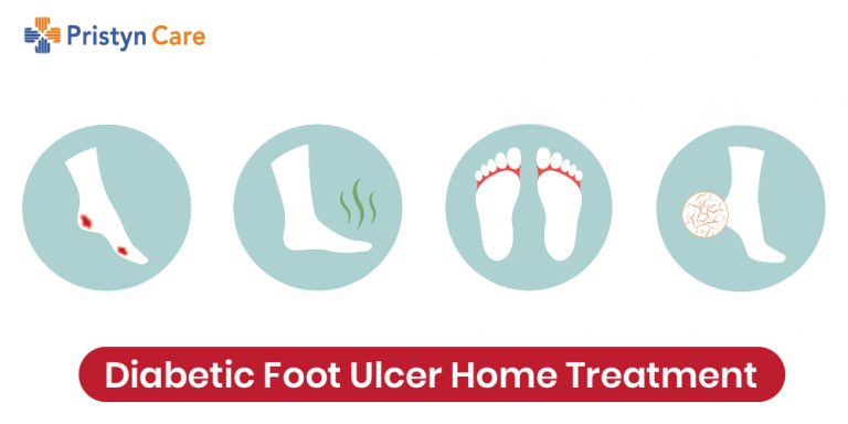 diabetic foot ulcer home treatment