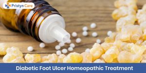 diabetic foot ulcer homeopathic treatment