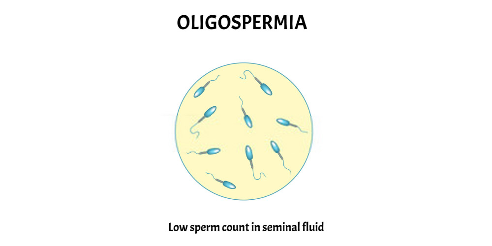 Smoking and sperm motility Smoking and sperm motility