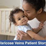 varicose veins patient story