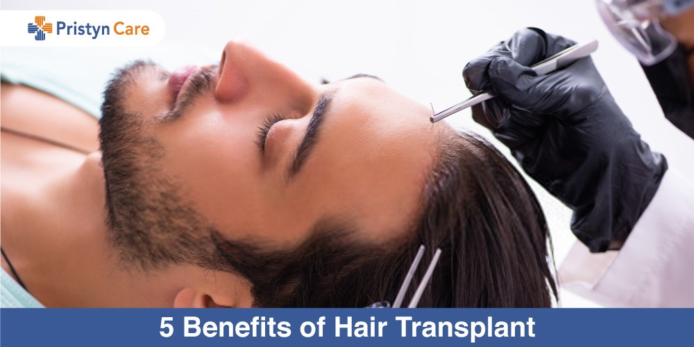 Hair Transplant