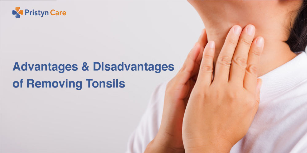 Pros And Cons Of Tonsil Removal Malander Mezquita