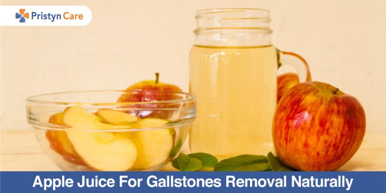 Apple juice for gallstones removal naturally