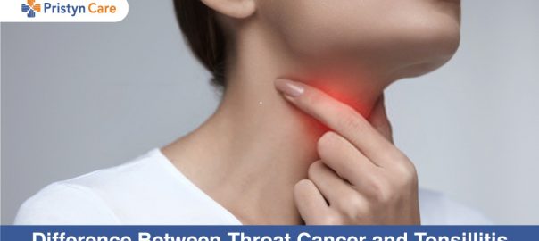 Difference Between Throat Cancer and Tonsillitis