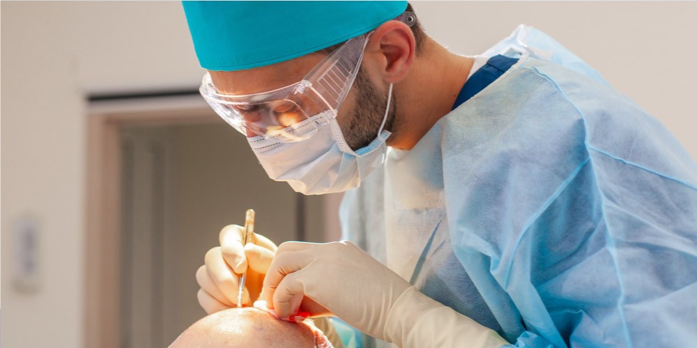 Hair Weaving or Hair Transplant- Which is Better? - Pristyn Care Hair Weaving or Hair Transplant- Which is Better? - Pristyn Care