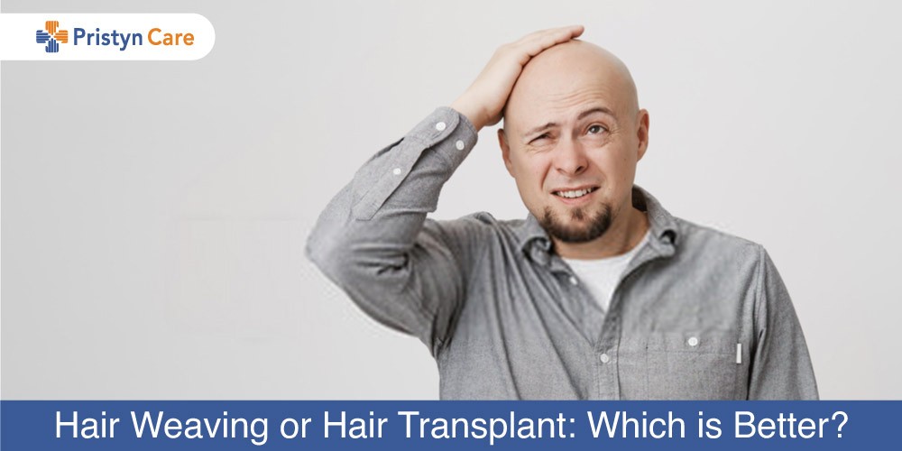 Hair Weaving or Hair Transplant- Which is Better? - Pristyn Care