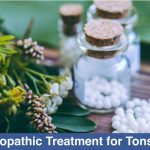 Homeopathic-Treatment-for-Tonsillitis
