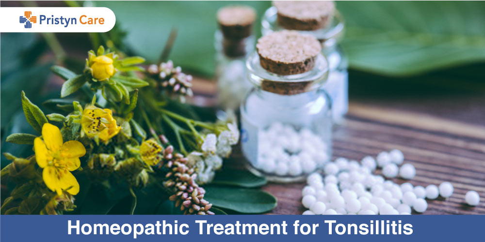 Homeopathic-Treatment-for-Tonsillitis