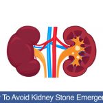 How-To-Avoid-Kidney-Stone-Emergency