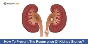 recurrence pristyncare